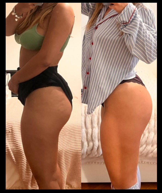 Resultado Aluna Reset 360°